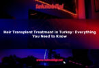 hair transplant treatment in turkey everything you need to know 16145