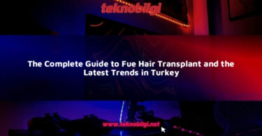 the complete guide to fue hair transplant and the latest trends in turkey 16148