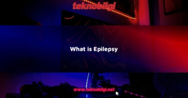 what is epilepsy 15955